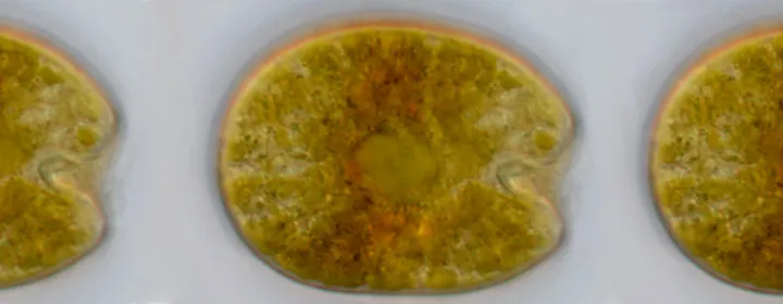 Dinophyceae (Photo Credit : lucidcentral)